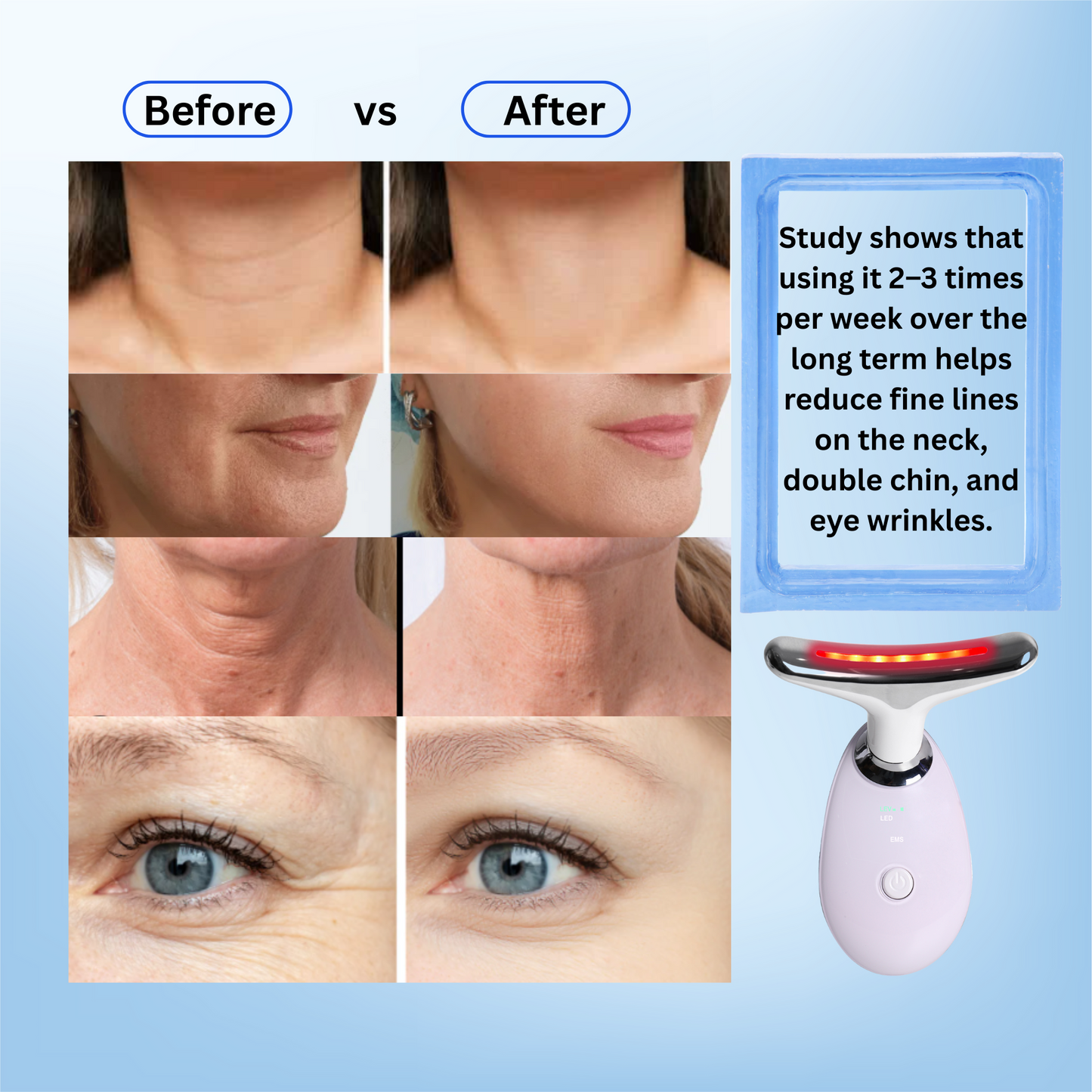 Aolemon Face & Neck Lifting Massager - At-Home Skin Tightening & Anti-Aging Device