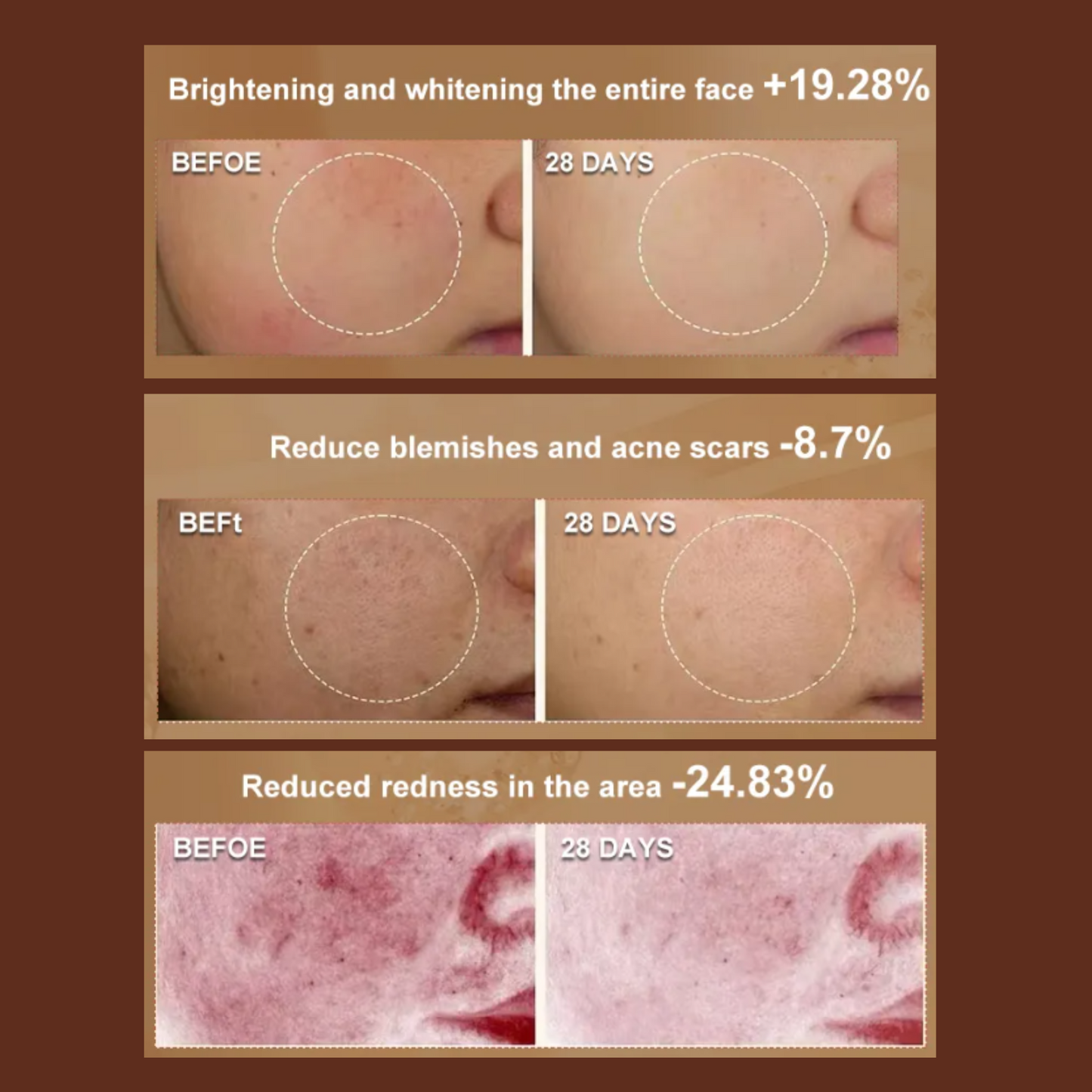 Aolemon Mutifuncational Beauty Device- Hot & Cold Facial Massager Anti-aging Winkle Reduction & Spot Improvement Skin Beauty Equipment