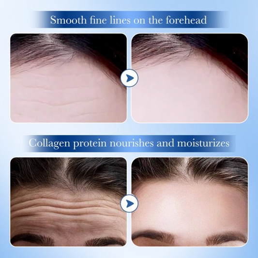 SADOER Forehead Smoothing Collagen Patch 12pcs