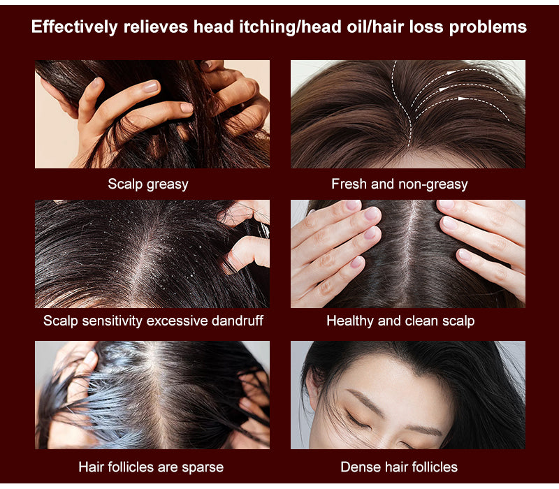 Aolemon Hair Growth Electric Massager Comb - Activates Scalp & Revitalizes Hair Roots Cordless Therapy Hair Brush